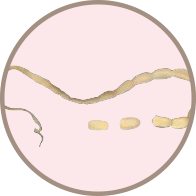 TAPEWORMS